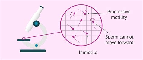 Sperm Motility and Fertility .